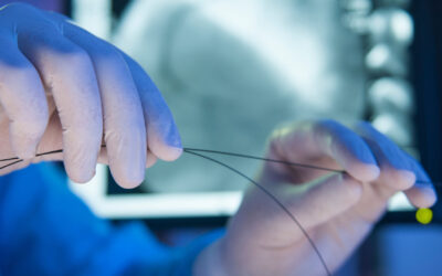 Vascular Specialist in New Jersey