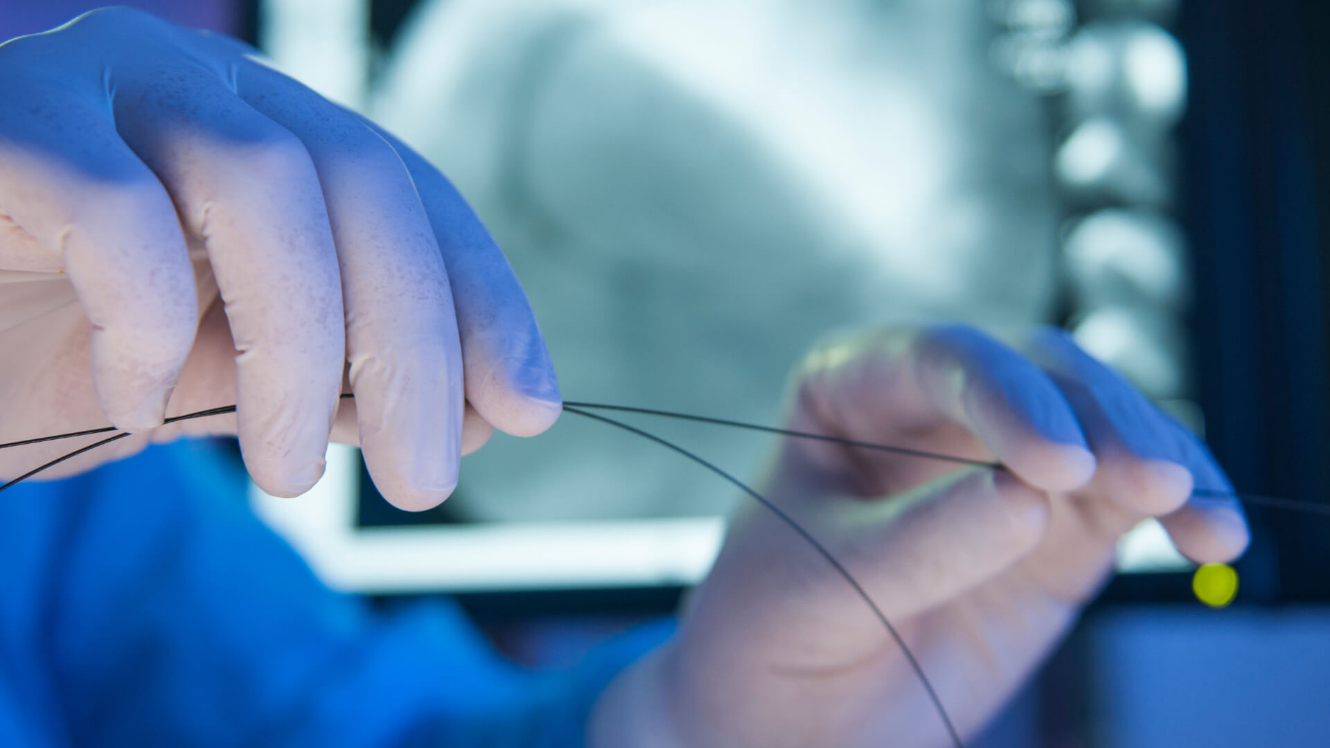 Angioplasty and Stenting Gloves Image Angioplasty and Stenting Gloves Image