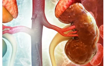 The Link Between Peripheral Arterial Disease and Chronic Kidney Disease