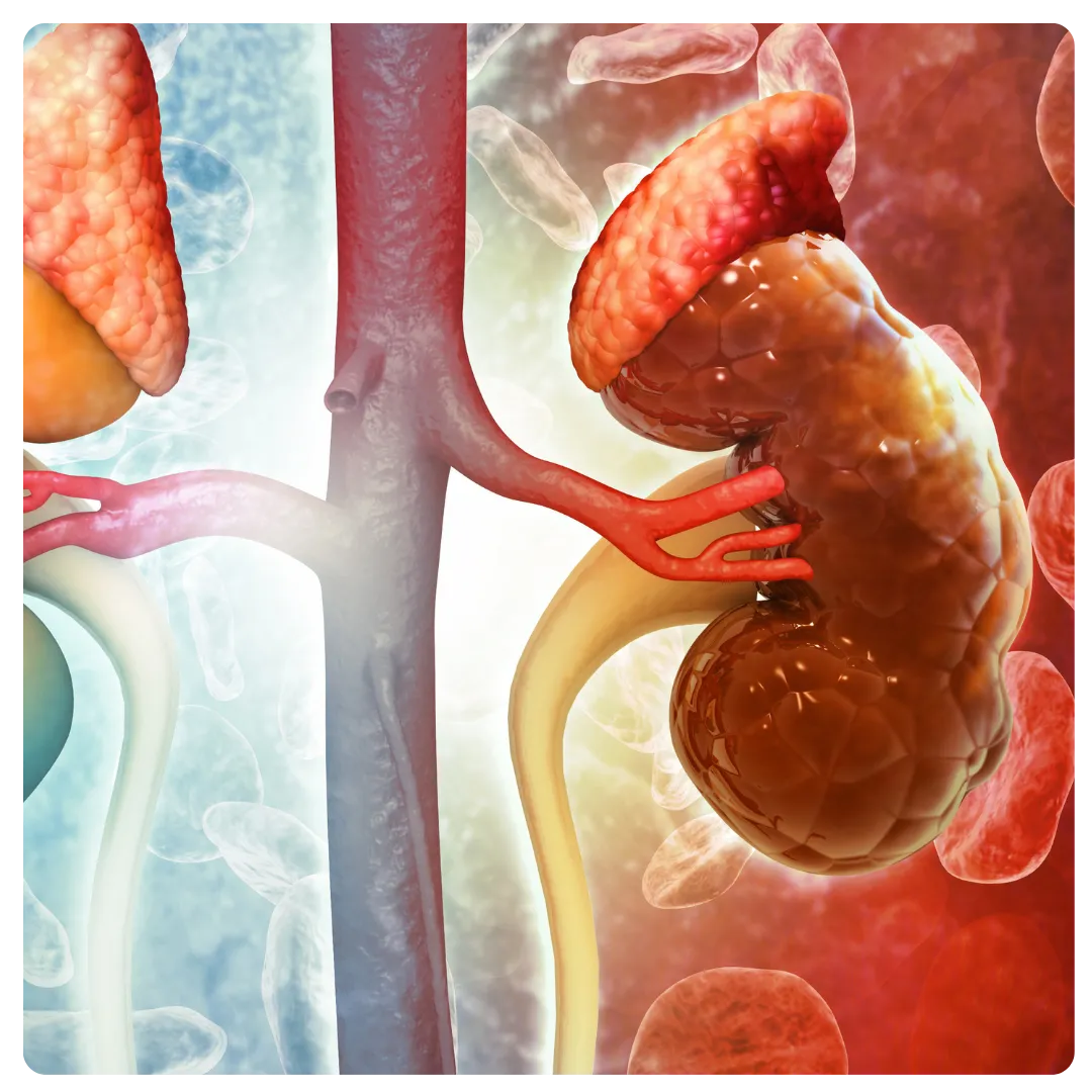 CKD