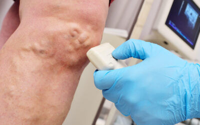 What’s a duplex vascular ultrasound and how does it work?