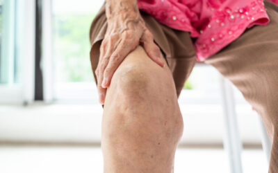 Non-compressible ABIs are associated with an increased risk of major amputation and major adverse cardiovascular events in patients with critical limb ischemia