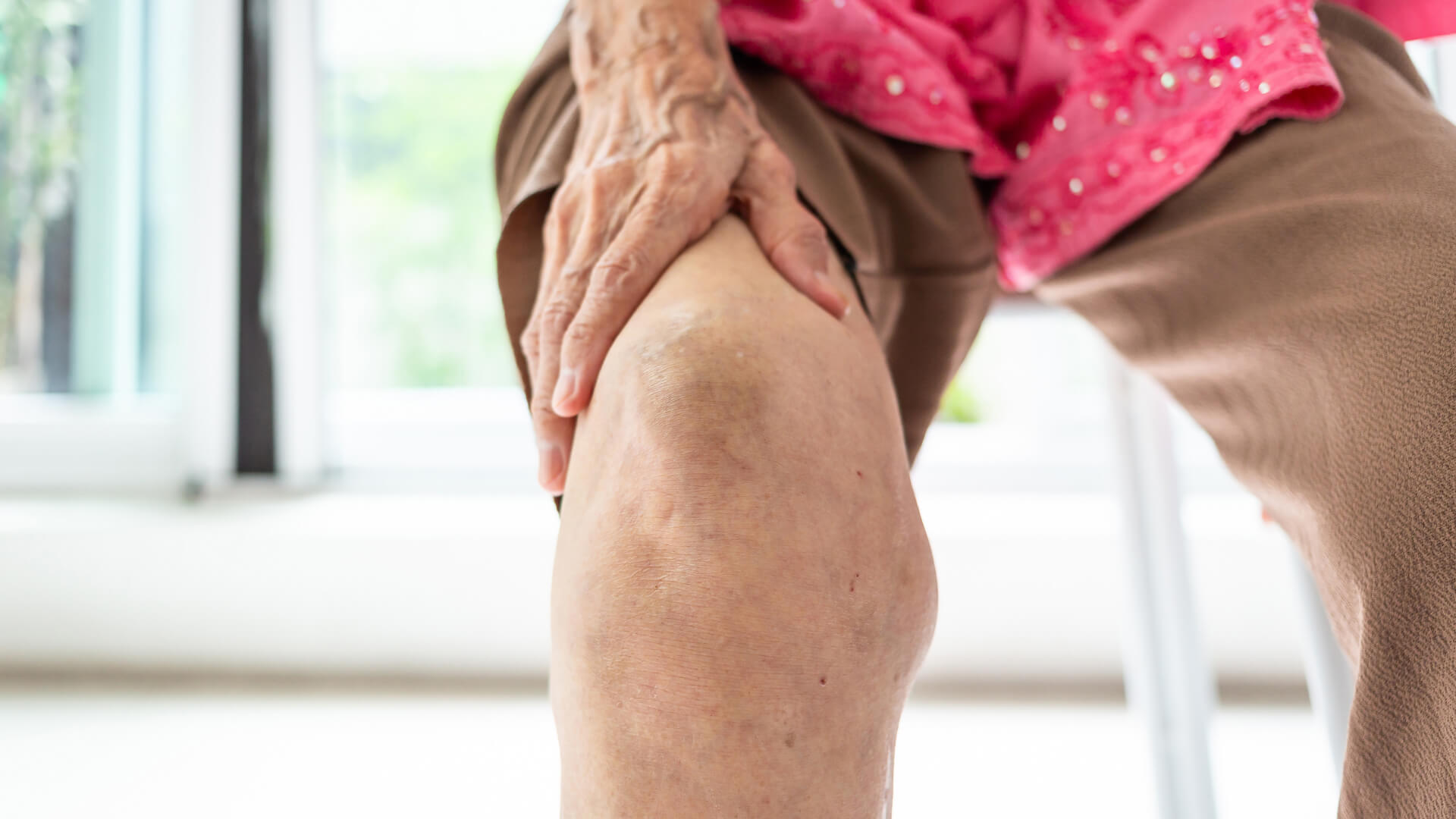 Osteoarthritis of the Knee Image Osteoarthritis of the Knee